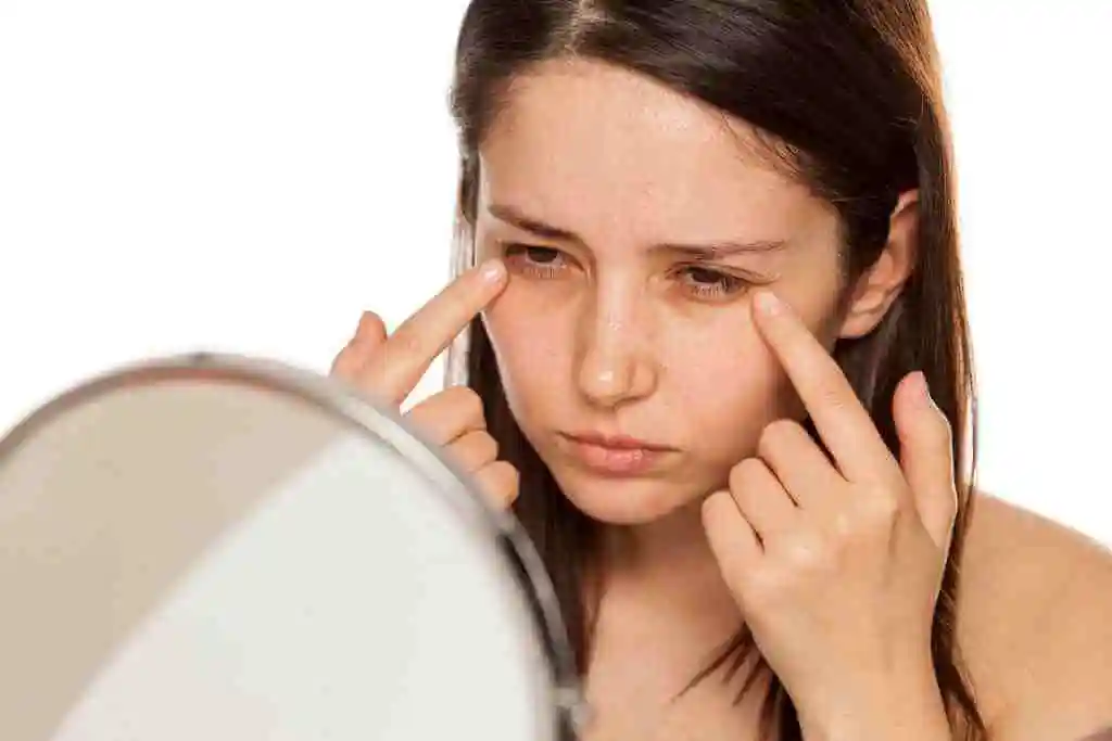 How to Remove Dark Circles