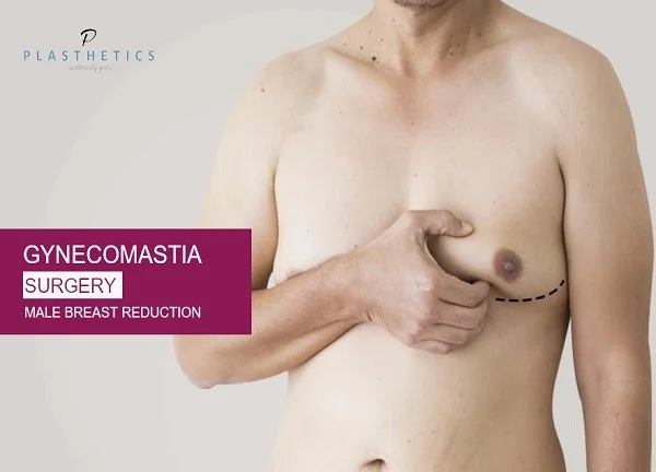 Gynecomastia-Surgery