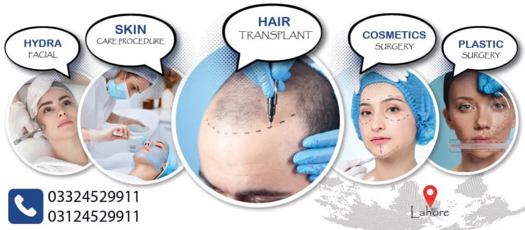 Hair-Transpalnt