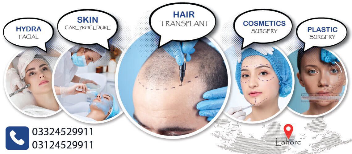 hair transplant in lahore